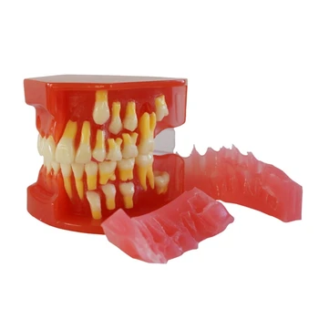 Модел на зъбите с 28 подвижни зъби Медицински обучителен инструмент Демонстрационен модел за възстановяване на зъбите за проучване